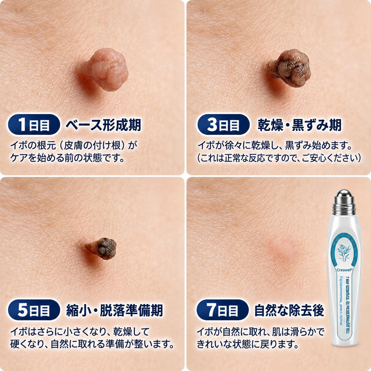 🇯🇵 👨‍⚕️🖋️Creawel® 公式ストア｜7日間集中ケア｜首元・デコルテの気になるポツポツを毎日ピンポイントケア🖋️🎞️