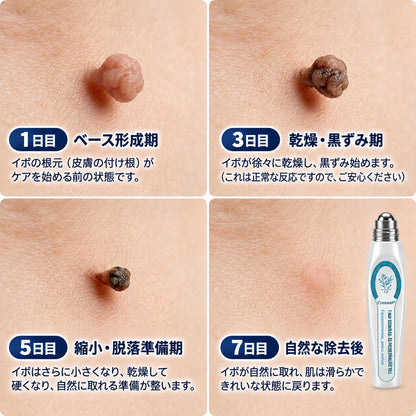 🇯🇵 👨‍⚕️🖋️Creawel® 公式ストア｜7日間集中ケア｜首元・デコルテの気になるポツポツを毎日ピンポイントケア🖋️🎞️