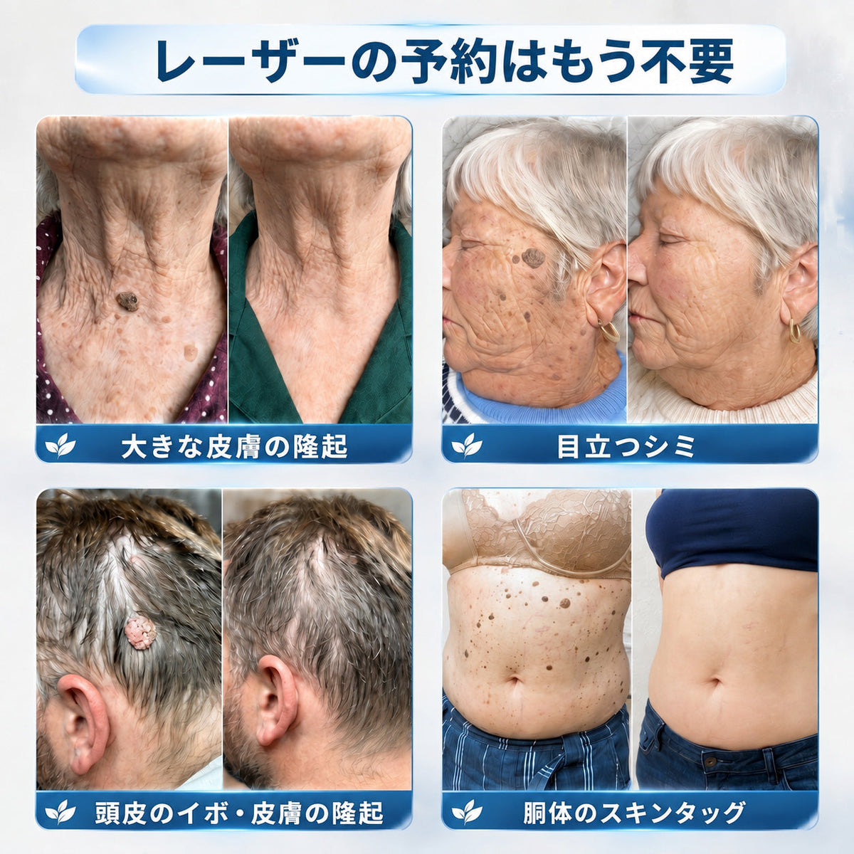 🇯🇵 👨‍⚕️🖋️Creawel® 公式ストア｜7日間集中ケア｜首元・デコルテの気になるポツポツを毎日ピンポイントケア🖋️🎞️