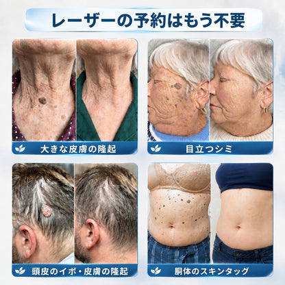 🇯🇵 👨‍⚕️🖋️Creawel® 公式ストア｜7日間集中ケア｜首元・デコルテの気になるポツポツを毎日ピンポイントケア🖋️🎞️