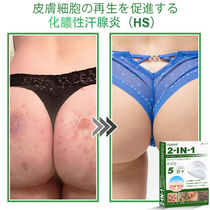 𝐇𝐮𝐝𝐫𝐨𝐬® 👑 𝟐-𝐢𝐧-𝟏 ハイドロコロイドマイクロニードルパッチ｜盛り上がったほくろ、ニキビ、平らなイボおよび皮膚の突起の除去用に特別設計｜𝟏𝟒𝟒枚入りパッケージ❄️