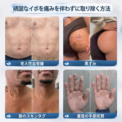 公式ブランドストア 🐉|⛸️Creawel® 7日間 タグ＆スポットイレーサー（無痛・跡残りゼロのローラーボール）