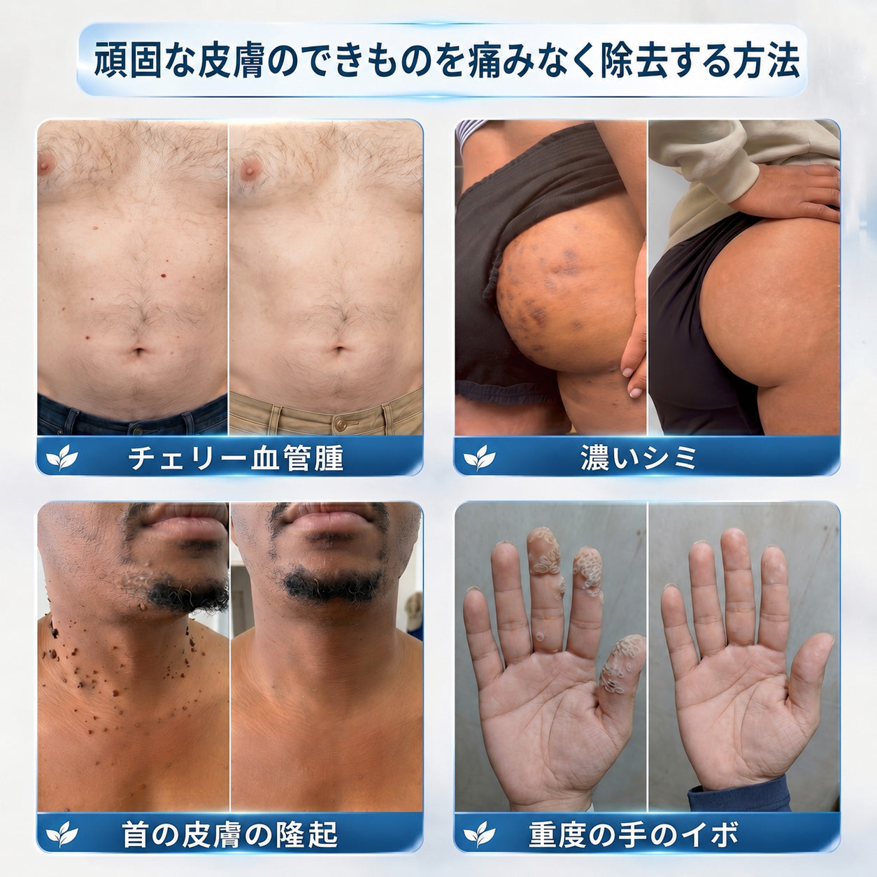 🇯🇵 👨‍⚕️🖋️Creawel® 公式ストア｜7日間集中ケア｜首元・デコルテの気になるポツポツを毎日ピンポイントケア🖋️🎞️
