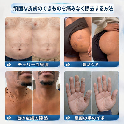 🇯🇵 👨‍⚕️🖋️Creawel® 公式ストア｜7日間集中ケア｜首元・デコルテの気になるポツポツを毎日ピンポイントケア🖋️🎞️