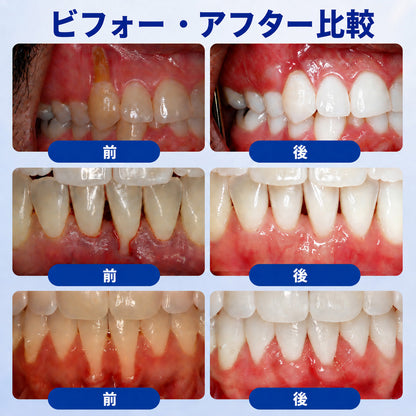 🇯🇵 👨‍⚕️✅🦷 HEATWOLF® GumRevive – 歯周組織修復ジェル 🦷✨