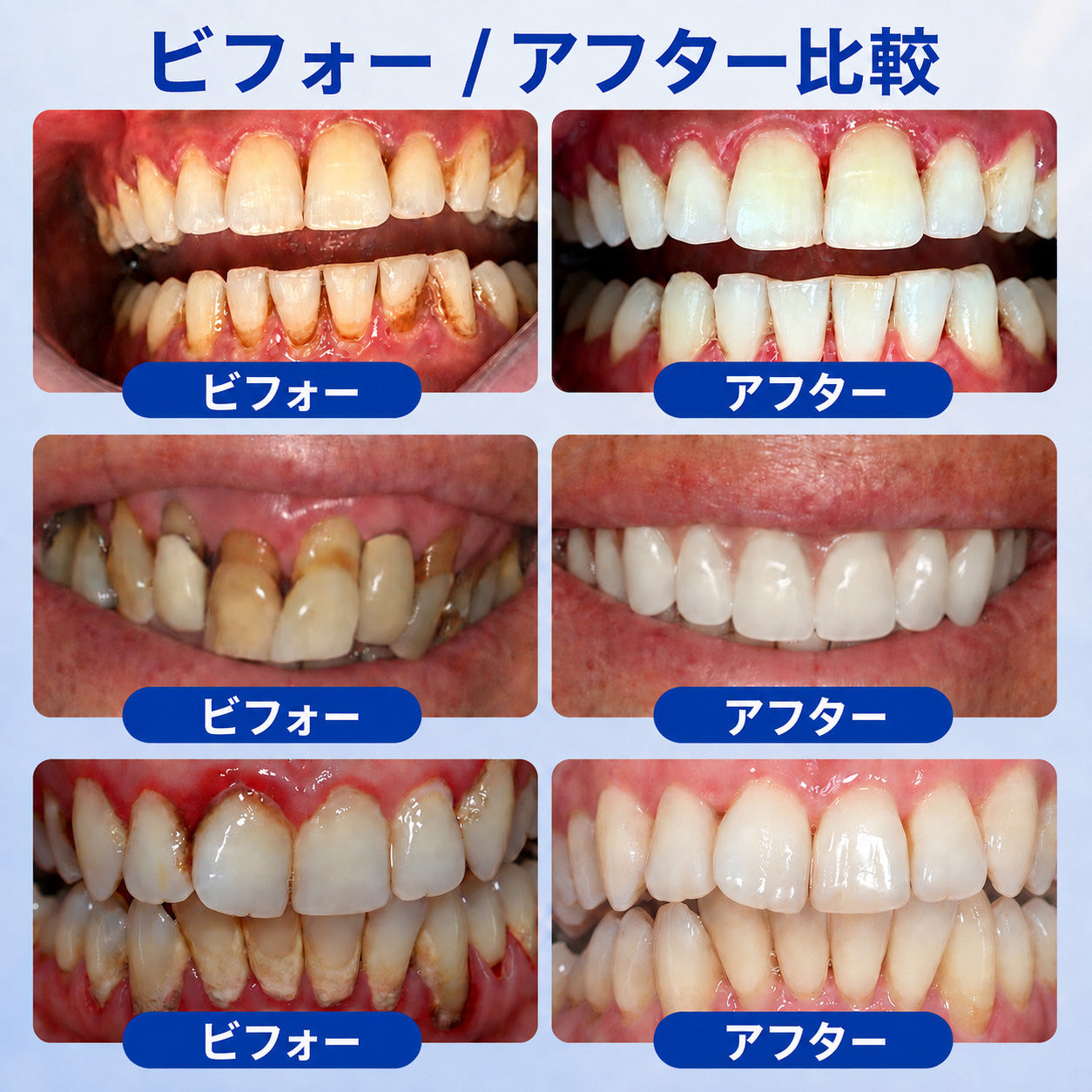 🇯🇵 👨‍⚕️✅🦷 HEATWOLF® GumRevive – 歯周組織修復ジェル 🦷✨